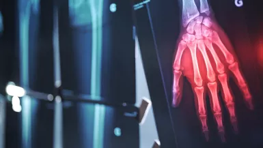 Radio "Mieux vivre avec l'arthrose"