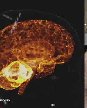 Enquêtes de région - les mystères du cerveau - Sylvie Malal - crédit FTV Enquêtes de région - les mystères du cerveau, avec Sylvie Malal