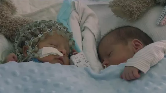 EDR médecine connectée EDR médecine connectée