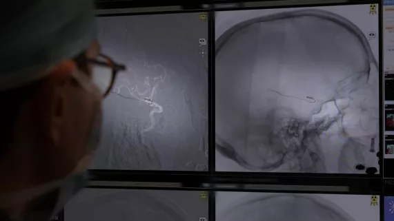 Enquête de santé : vaincre l'AVC