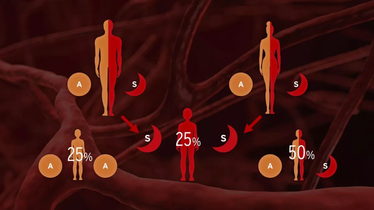 DREPANOCYTOSE, LA DOULEUR EN HERITAGE